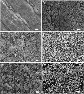 Amelogenin Peptide-Chitosan Hydrogel for Biomimetic Enamel Regrowth